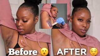 WAX Your Underarms AT HOME + How To Lighten Dark Underarms Naturally Detailed