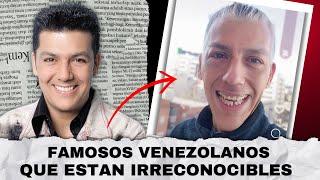 Así cambiaron físicamente estos famosos venezolanos