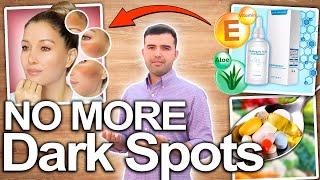 CLEAR YOUR SKIN NOW How To Eliminate Dark Spots Skin Stains and Sun Spots For Good