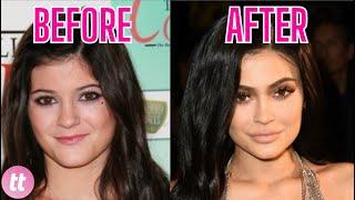 Kylie Jenner Is Allegedly Obsessed With Plastic Surgery
