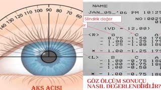 Gözlük Reçete Bilgisi  Göz Ölçüm Sonucu İncelemesi