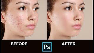 Skin Retouching Face Smooth - Photoshop