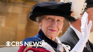 Princess Anne hospitalized with concussion