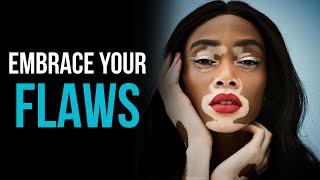 How to embrace your flaws?  @RealWoman
