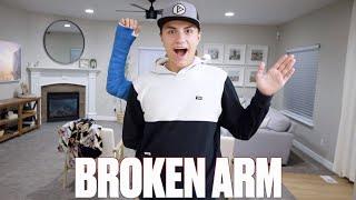 ANOTHER BROKEN BONE