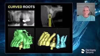 Indications for and Advantages of Short 6 mm Dental Implants