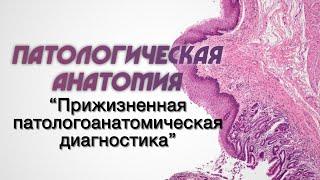 Клиническая патологическая анатомия №2 Прижизненная патологоанатомическая диагностика