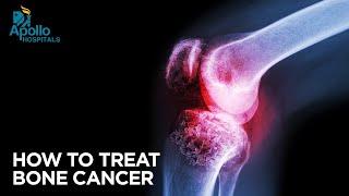 Identifying and managing cancer of the bone Early Signs of Bone Cancer Apollo Hospitals