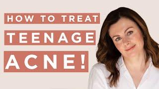 How To Treat Teen Acne  Dr Sam Bunting