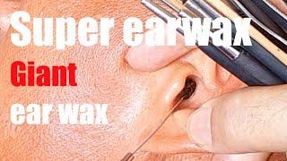 Super ear wax  Ear wax removal satisfying with barber Vietnam