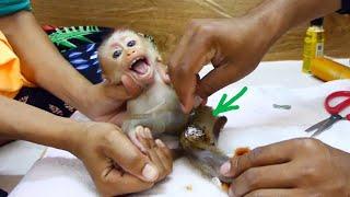 Poor Girl Monkeys Struggle C-ry Anqry Her Dad Put Medicine On Her Injure