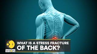 Breaking down Bumrahs injury What is stress fracture of the back?  Latest News  WION