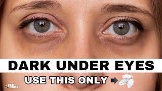 Remove dark under eye circles in just 1 WEEK  Sustainable lifestyle tip -1