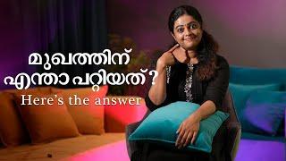 മുഖത്തിന് എന്താ പറ്റിയത്? Here’s the answer  Aswathy Sreekanth  Life Unedited #aswathysreekanth