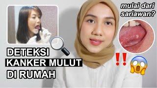 CARA DETEKSI KANKER MULUT DI RUMAH  All you need to know about Oral Cancer
