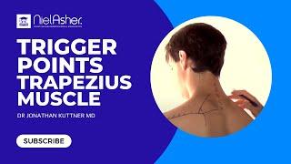 Trapezius Trigger Points - Self Treatment