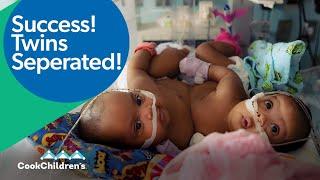Meet AmieLynn & JamieLynn  Our First-ever Separation Surgery for Conjoined Twins  Cook Childrens