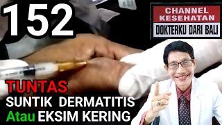 Pengobatan penyakit  kulit Dermatitis Kronis atau Eksim Kering dng Suntikan di bawah kulit.