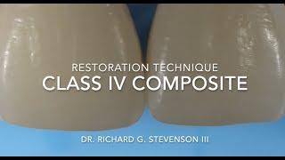 Class IV Composite Restoration  Restoration Technique