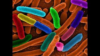 UW study finds E. coli in some womens intestines