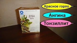 Отвар коры дуба как приготовить. Ангина. Фарингит. Тонзиллит. Как правильно полоскать больное горло