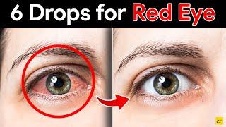 Fast and Effective 6 Eye Drops to Cure Red Eyes - Credihealth