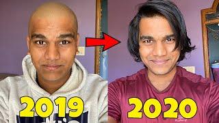 I Clicked a Photo Everyday for 1 Year Bald to hairy