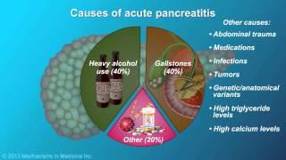 Acute Pancreatitis