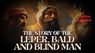 The Story Of The Leper The Bald And The Blind Man