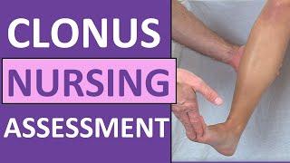 Clonus Test Positive Reflex Sign Preeclampsia Pregnancy - Nursing Skills