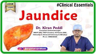 Jaundice Clinical essentials - Dr. Kiran Peddi MRCPUK FRCPLondon CCTGastro