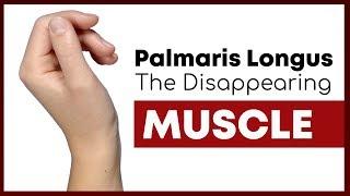 Palmaris Longus The Muscle You Might Not Have  Corporis