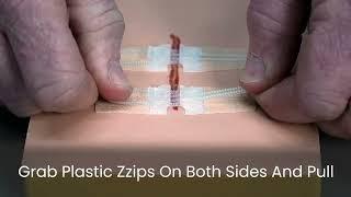 How to use Longmed ZIP STITCH Wound Closure Device