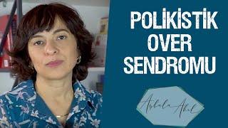 Polikistik Over Sendromu Op.Dr. Aybala Akıl