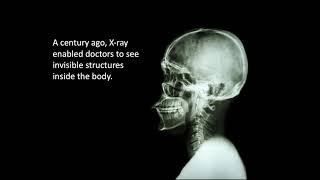 AI is to Medicine Today What the X ray was to Medicine a Century Ago