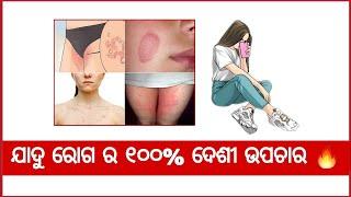 Jadu kachu kundiya ku gharei upachara re bhala kemiti karibe?  odia health tips