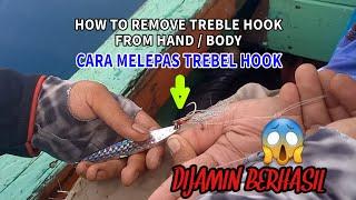 Tips Cara melepas kail atau trebel hook yg menancap di tangan badan saat mancing