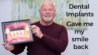 My failing bridge was replaced with dental implants  Durham Dental Solutions