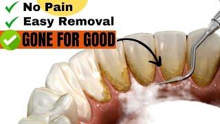 4 Secrets to Never have dental plaque again Hint its all natural