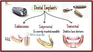 3 Types of Dental Implants and Surface treatments explained