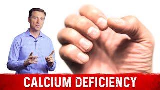 Causes & Symptoms Of Calcium Deficiency – Dr. Berg