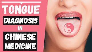 Tongue Diagnosis in TCM made easy