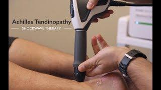 Shockwave Therapy - Achilles Tendinopathy