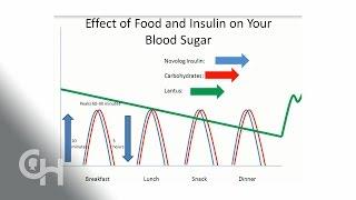 BasalBolus insulin and Carbohydrates