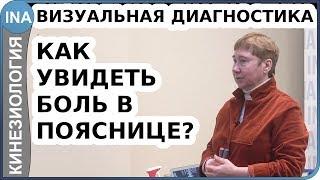 Как увидеть боль в пояснице? Визуальная диагностика. Васильева кинезиология