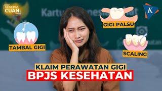 GENERASI CUAN Cara Dapat Gigi Palsu hingga Tambal Gratis dari BPJS Kesehatan