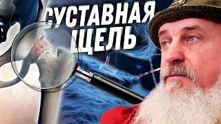 Что такое СУСТАВНАЯ ЩЕЛЬ??? Коксартроз - О САМОМ ГРАВНОМ  Тренер Хапаев