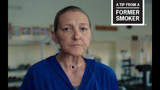 CDC Tips From Former Smokers - Sharon A.’s “Treadmill” Tips Commercial