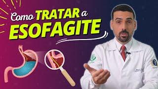 ESOFAGITE Como TRATAR a ESOFAGITE de Forma Natural? Tudo que você precisa saber.