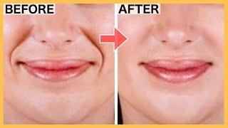 SMILE LINES Facial Exercises Nasolabial Folds Laugh Lines  Lift Smile Lines with this WORKOUT